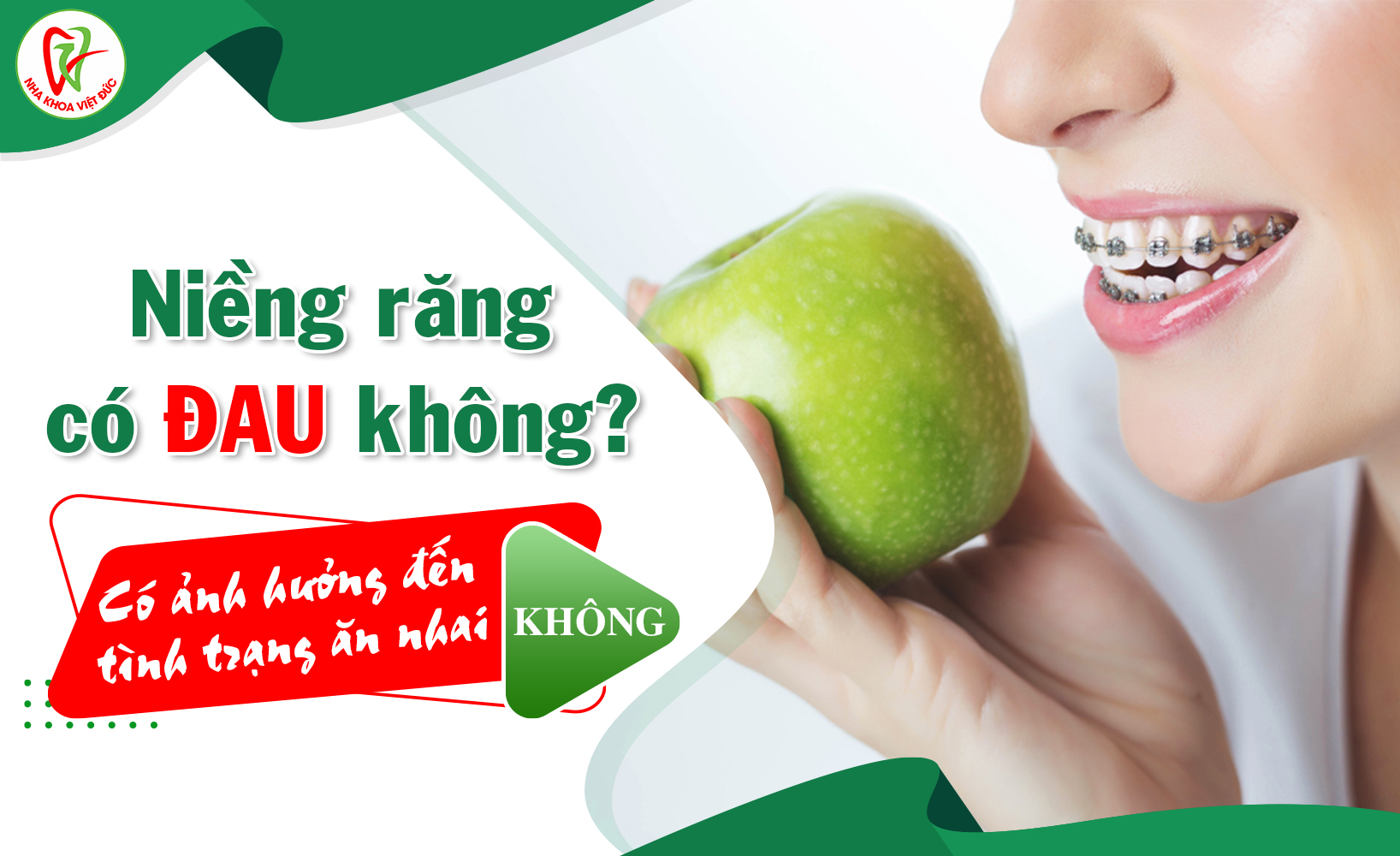 Niềng Răng Có Đau Không Bao Lâu